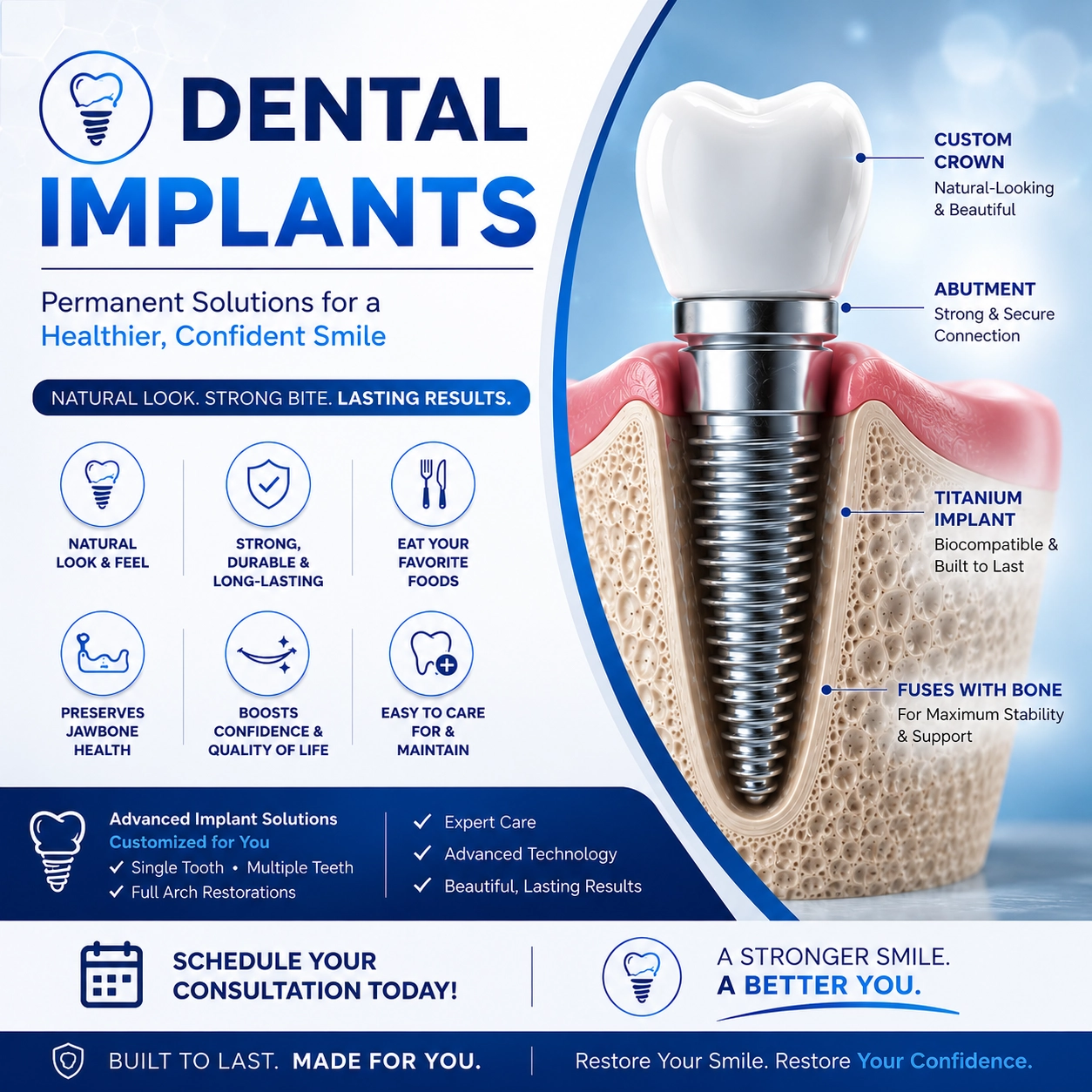 Dental Implants – Permanent Tooth Replacement Solutions 3D dental implant illustration showing titanium implant, abutment, and custom crown for permanent tooth replacement