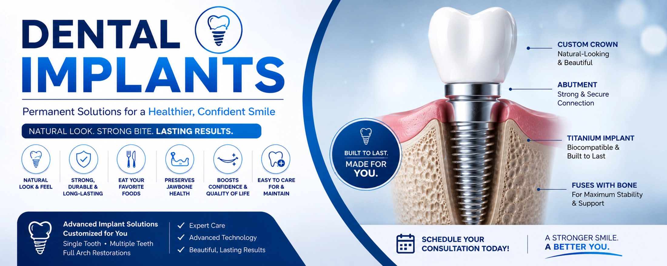Dental Implants – Permanent Tooth Replacement Solutions 3D dental implant illustration showing titanium implant, abutment, and custom crown for permanent tooth replacement