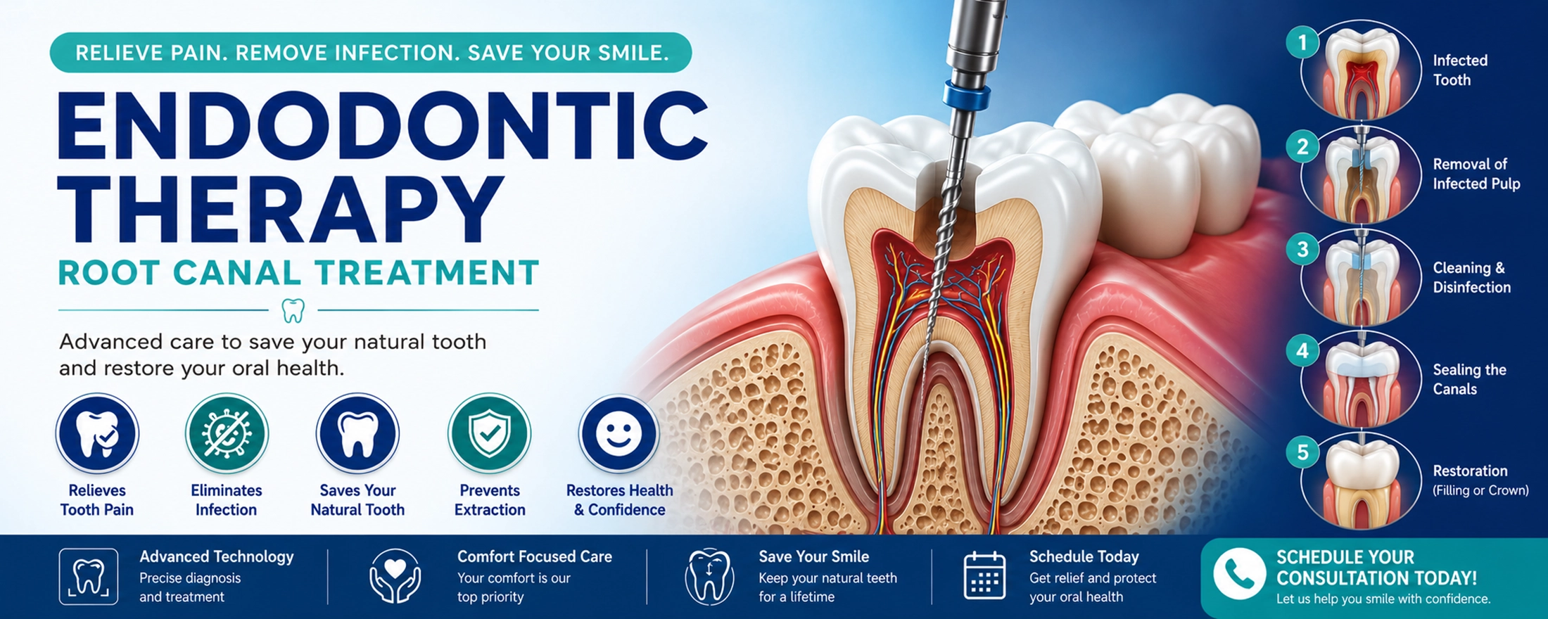 Endodontic Therapy Root Canal Treatment 3D Dental Banner 3D illustration of endodontic therapy and root canal treatment showing infected tooth cleaning, canal sealing, and tooth restoration process.