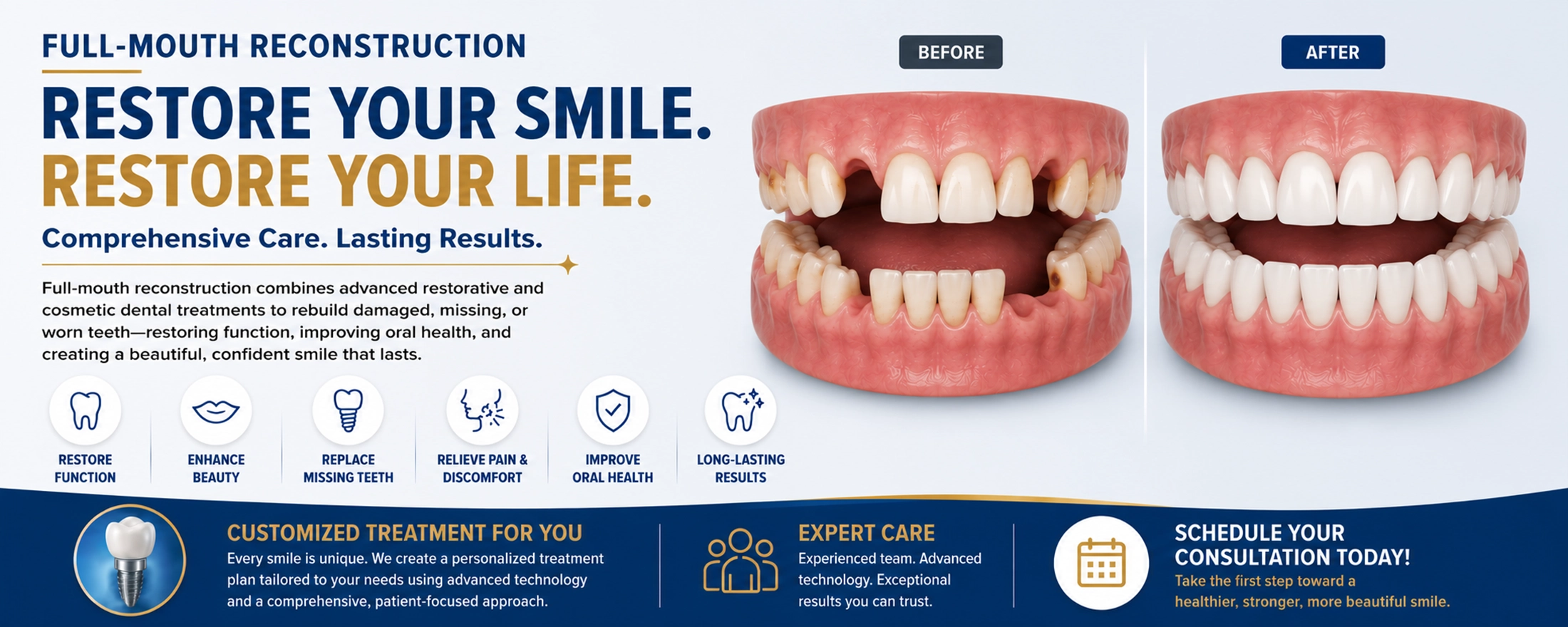 Full-Mouth Reconstruction Before and After Dental Restoration 3D before and after full-mouth reconstruction dental restoration showing five missing teeth replaced with a healthy restored smile