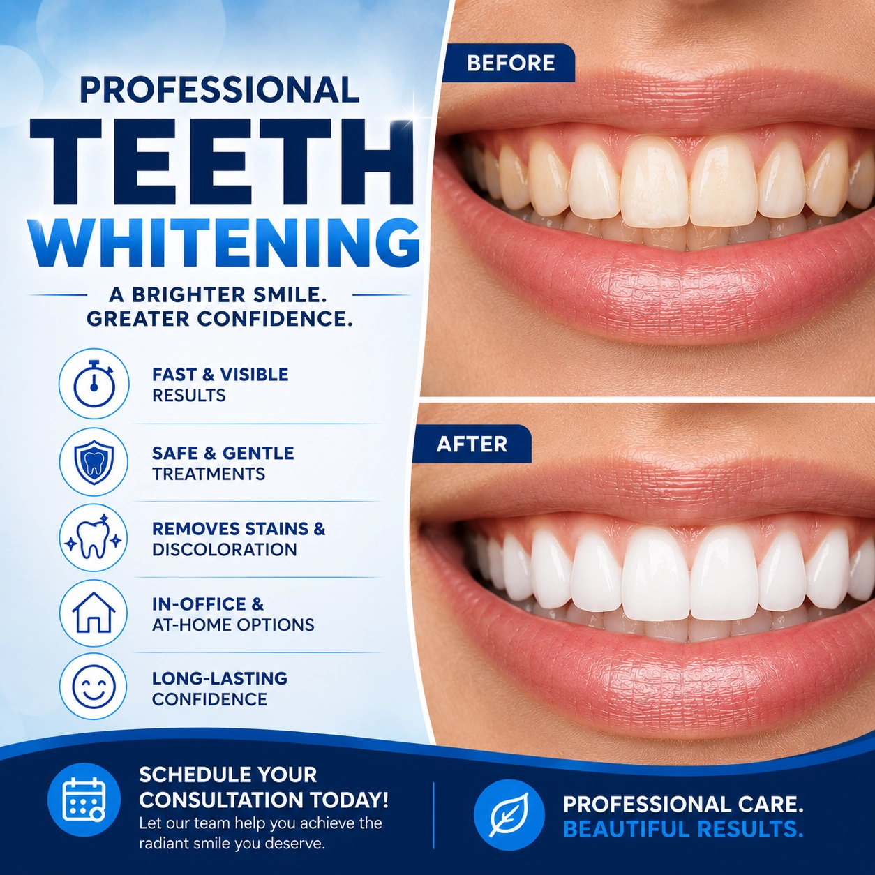 Before and after professional teeth whitening treatment showing realistic stain removal and a brighter white smile.