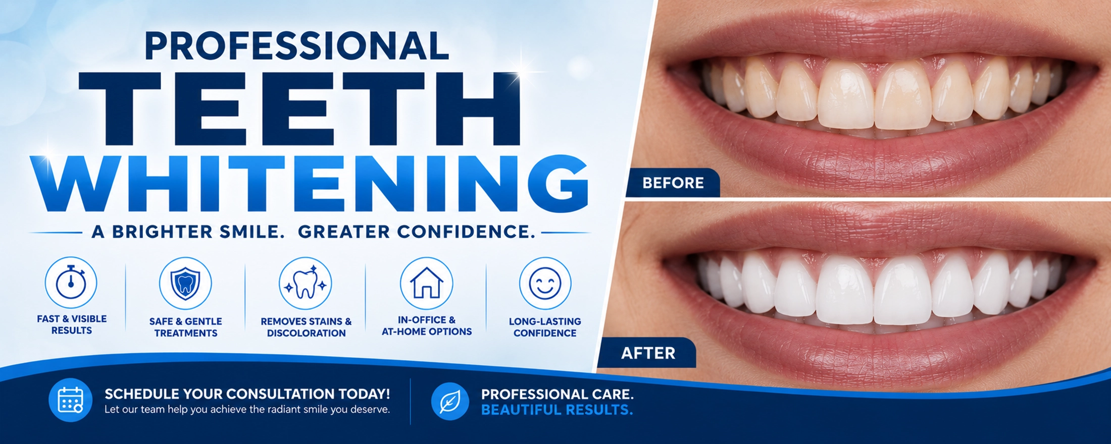 Before and after professional teeth whitening treatment showing realistic stain removal and a brighter white smile.