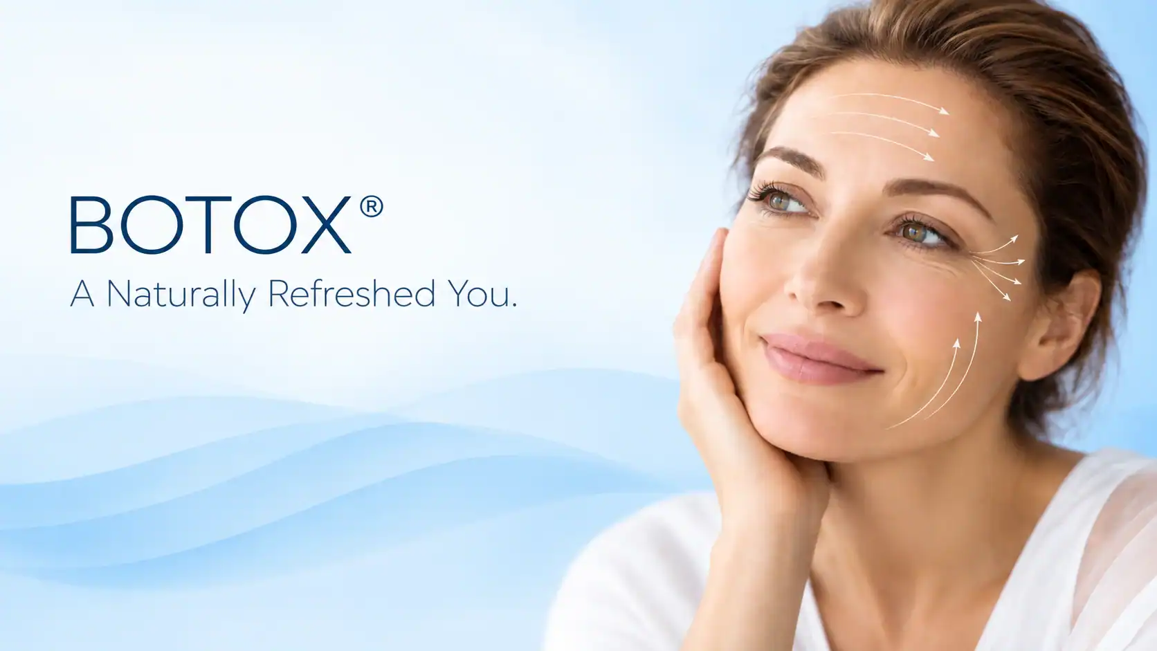 Botox® facial aesthetics preview at Peosta Dental