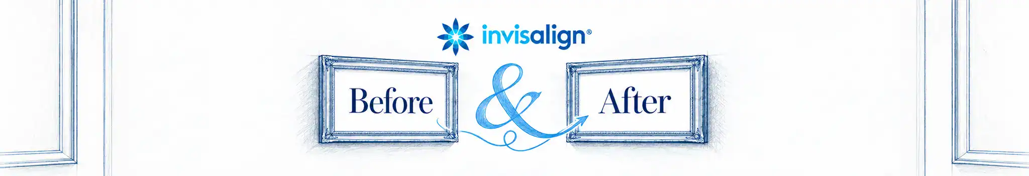Invisalign® results banner