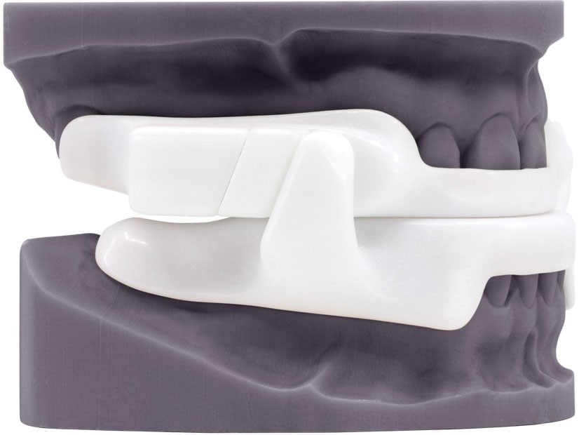 Panthera X3 custom mandibular advancement oral appliance for obstructive sleep apnea